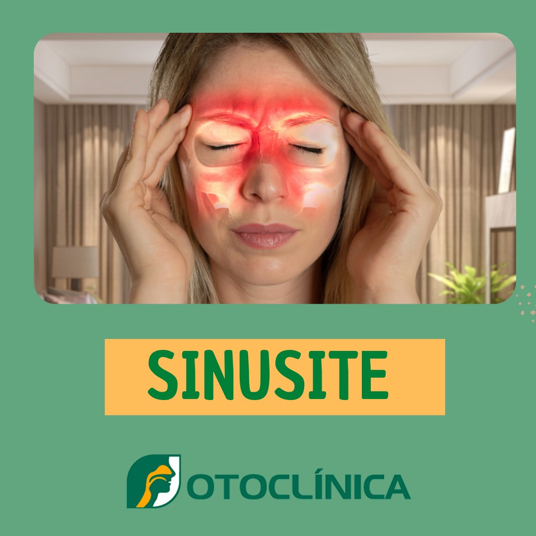 Sinusite